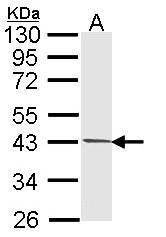PIM2 Rabbit Polyclonal Antibody
