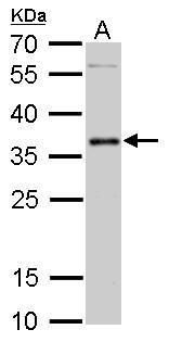 PIM2 Rabbit Polyclonal Antibody