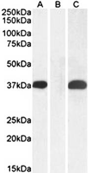PIM2 (Internal) Antibody