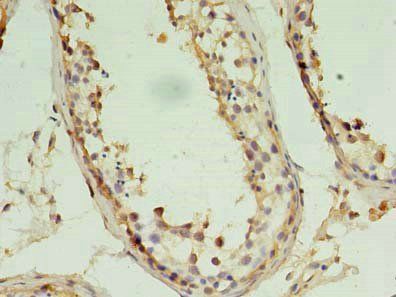 PIN1 Antibody