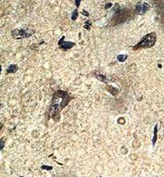 PIP4K2A Rabbit Polyclonal Antibody