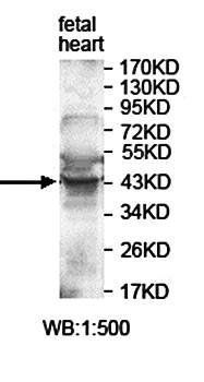 PIP4K2A Rabbit Polyclonal Antibody