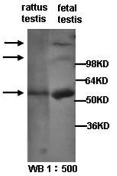 PIWIL1 Rabbit Polyclonal Antibody