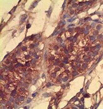 PIWIL1 Rabbit Polyclonal Antibody