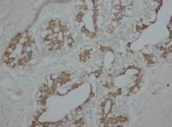 PKC alpha/PRKCA Rabbit Polyclonal Antibody