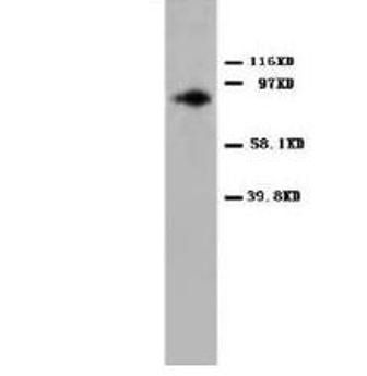 PKC alpha/PRKCA Rabbit Polyclonal Antibody