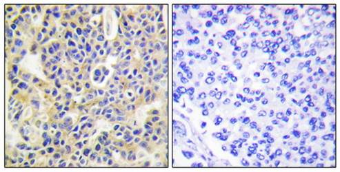 PKC θ (Phospho-Ser695) Antibody