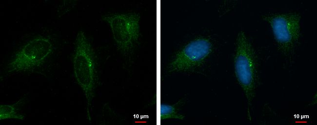 PKD2 Rabbit Polyclonal Antibody