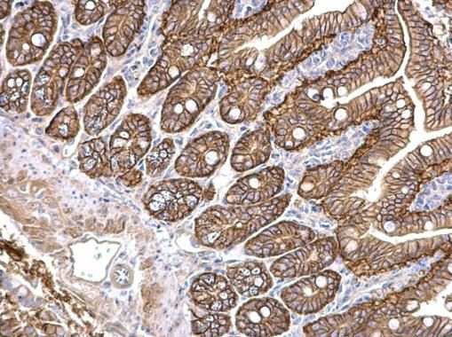 PKD2 Rabbit Polyclonal Antibody