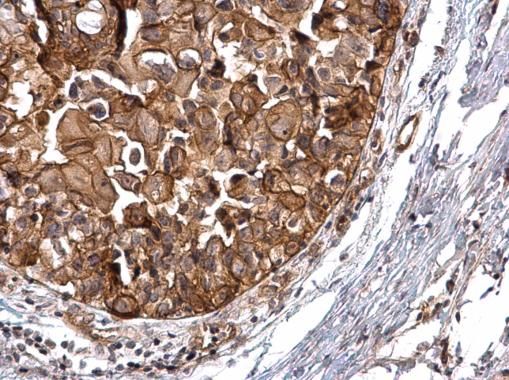 PKD2 Rabbit Polyclonal Antibody
