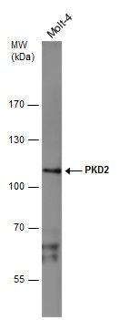PKD2 Rabbit Polyclonal Antibody