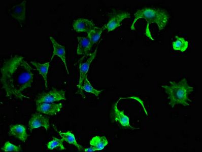 PKIB Antibody