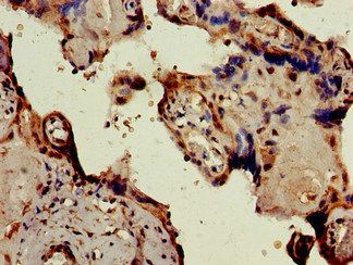 PKIB Antibody