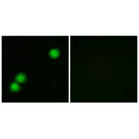 PKIB Antibody