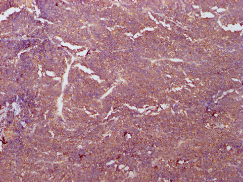 PKM Monoclonal Antibody