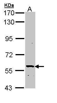 ATP6V1H Rabbit Polyclonal Antibody