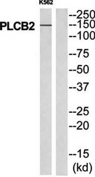 PLCB2 Antibody