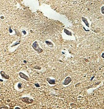 PLCB2 Rabbit Polyclonal Antibody