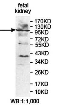 PLCB2 Rabbit Polyclonal Antibody