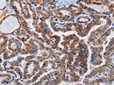 PLCB3 Antibody