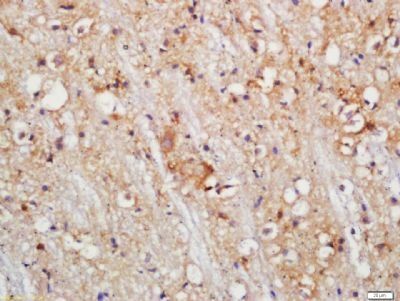 PLDL1 Rabbit Polyclonal Antibody