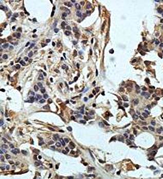 PLDN Rabbit Polyclonal Antibody