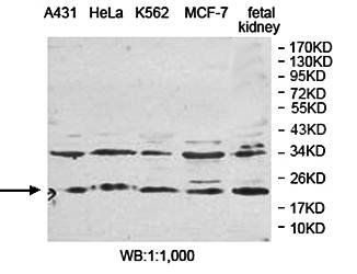 PLDN Rabbit Polyclonal Antibody