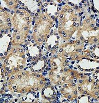 PLEKHA9 Rabbit Polyclonal Antibody