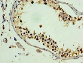 PLEKHB2 Antibody