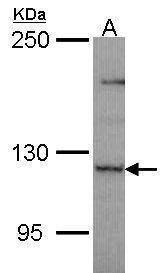 PLEKHG4 antibody [N1N2], N-term