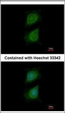 Plexin D1 Rabbit Polyclonal Antibody