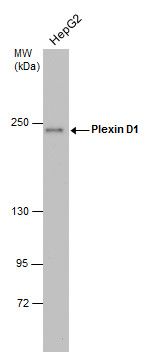 Plexin D1 Rabbit Polyclonal Antibody