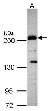 Plexin D1 Rabbit Polyclonal Antibody