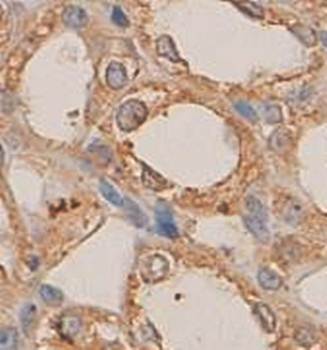 Plexin-B1 Rabbit Polyclonal Antibody