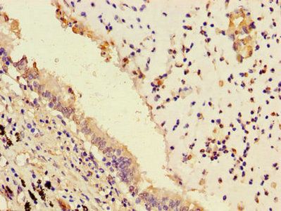 PLPP3 Antibody