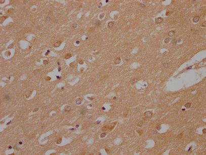 PLPPR1 Antibody
