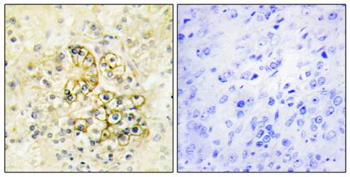 PMEPA1 Antibody