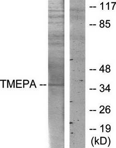 PMEPA1 Antibody