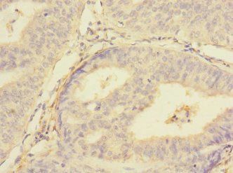 PMPCA Antibody