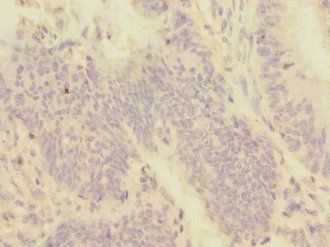 PMPCA Antibody