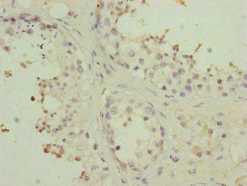 PMPCB Antibody