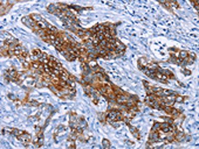PMPCB Antibody