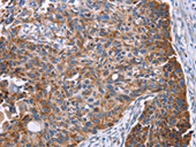 PMPCB Antibody