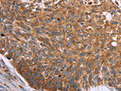 PMPCB Antibody