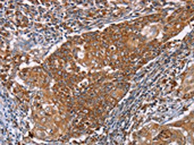 PMPCB Antibody