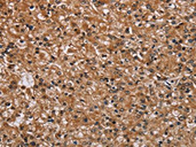 PMS2 Antibody