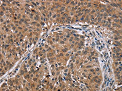 PMS2 Antibody