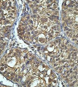 PNKP Rabbit Polyclonal Antibody