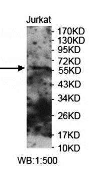 PNKP Rabbit Polyclonal Antibody