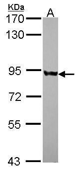 PNPase Rabbit Polyclonal Antibody